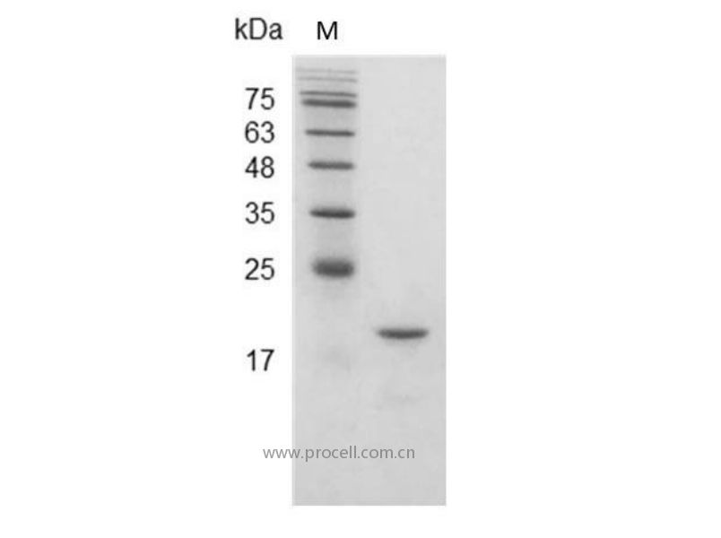 IFNβ 1a/IFNB1, Mouse, Recombinant