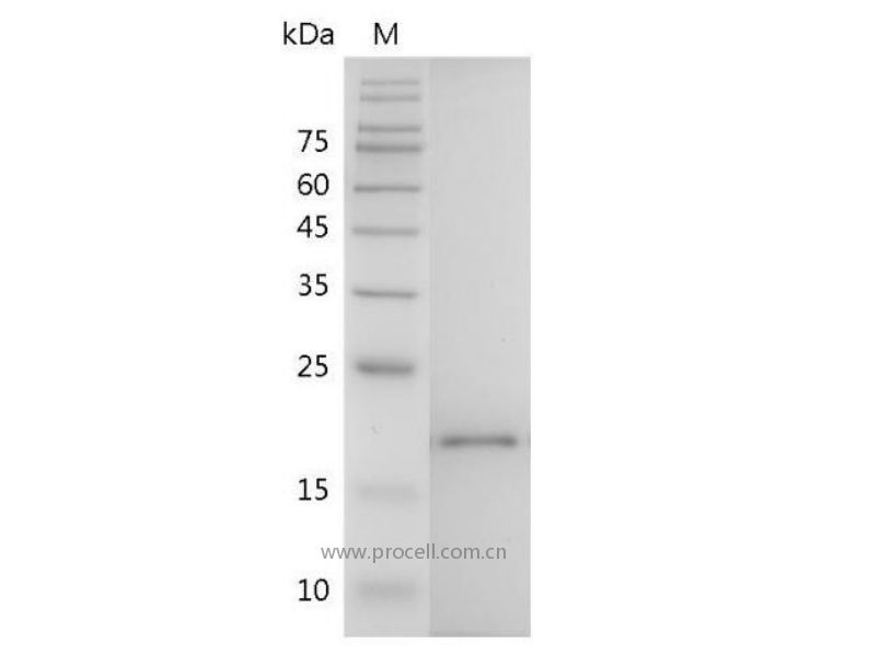 IL-38/IL1F10, Mouse, Recombinant