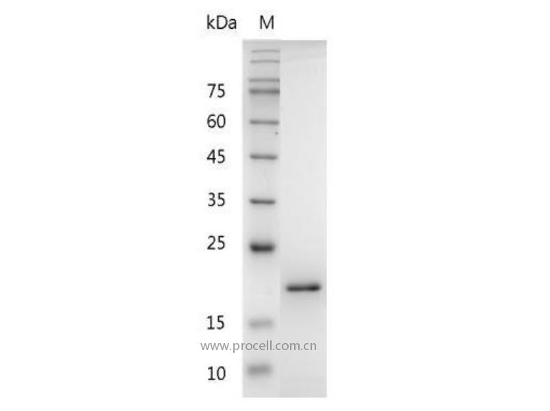 FasL/TNFSF6/CD95L/CD178, Mouse, Recombinant