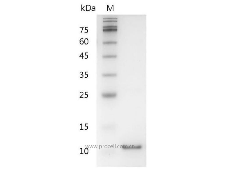 IL-5/EDF/BCDFII/TRF, Human, Recombinant