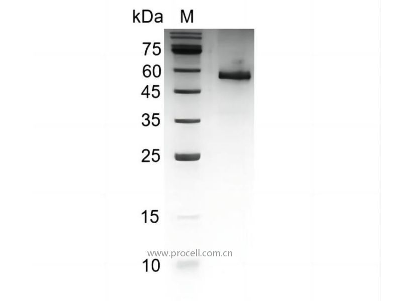 Noggin/NOG/SYM1/SYNS1, Human, Recombinant