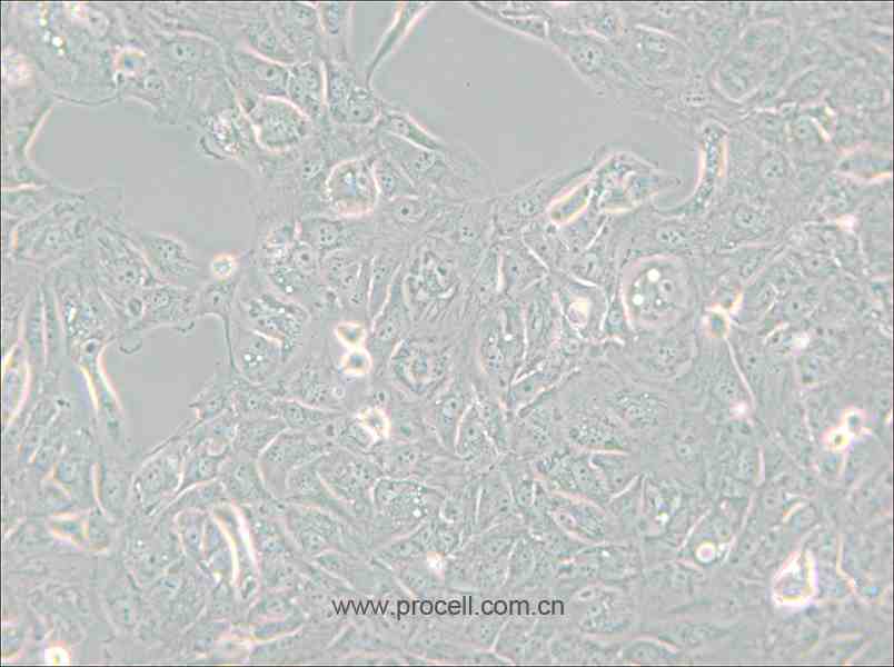 769-P (人肾细胞腺癌细胞) (STR鉴定正确)