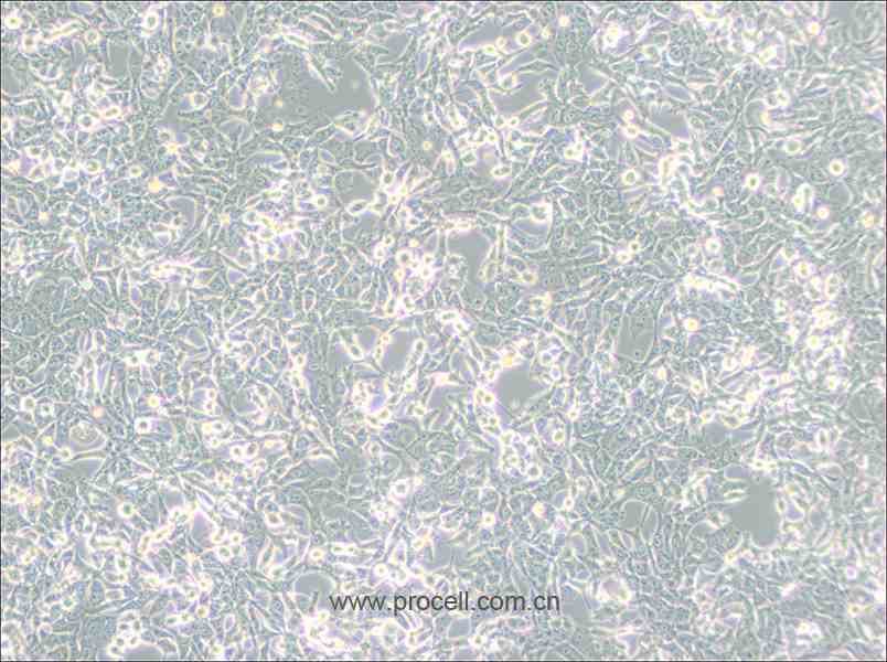 95-D [PLA-801D] (人高转移肺癌细胞) (STR鉴定正确)