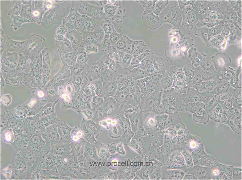 Caov-3 (人乳突状卵巢腺癌细胞) (STR鉴定正确)