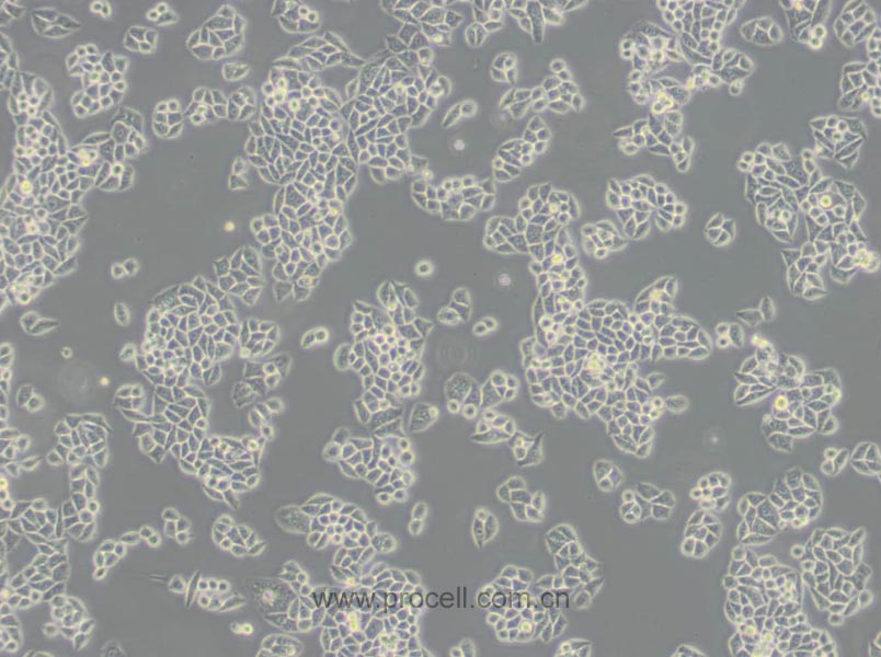 Eca-109 (人食管癌细胞) (Hela污染细胞系，暂不供应)