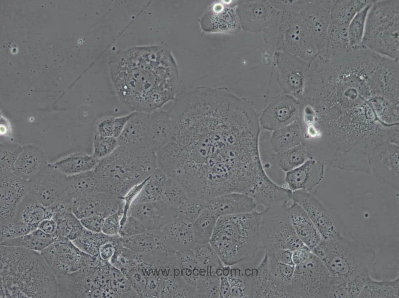 HCC1937 (人乳腺癌细胞) (STR鉴定正确)