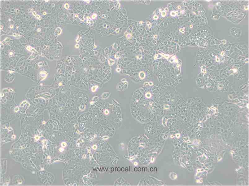 HEC-1-A (人子宫内膜腺癌细胞) (STR鉴定正确)