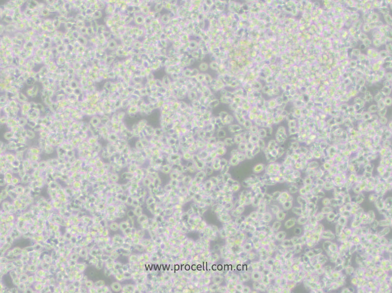 HMy2.CIR (人B淋巴母细胞) (STR鉴定正确)