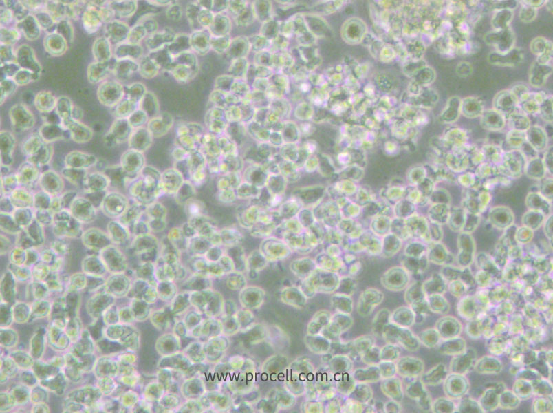 HMy2.CIR (人B淋巴母细胞) (STR鉴定正确)