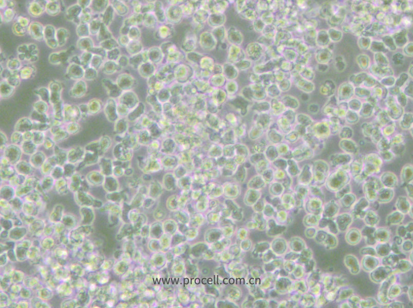 HMy2.CIR (人B淋巴母细胞) (STR鉴定正确)