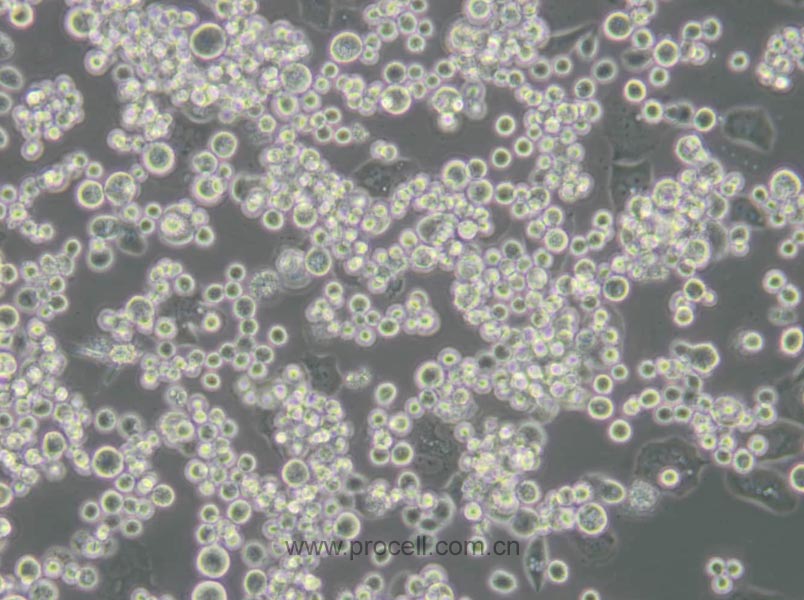 MDA-MB-453 (人乳腺癌细胞) (STR鉴定正确)