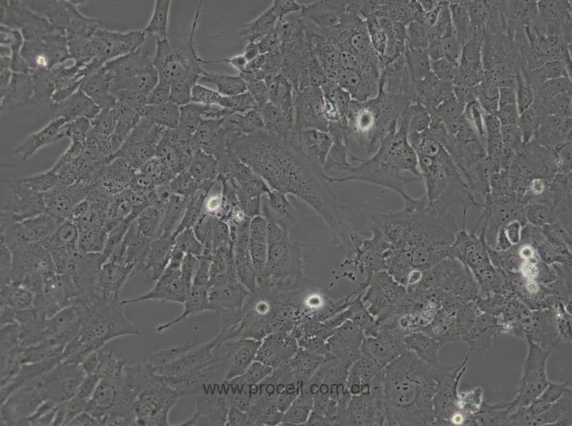 RF/6A (猴脉络膜-视网膜内皮细胞) (种属鉴定正确)