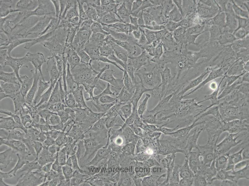 SW579 [SW 579; SW-579] (人甲状腺鳞癌细胞) (STR鉴定正确)