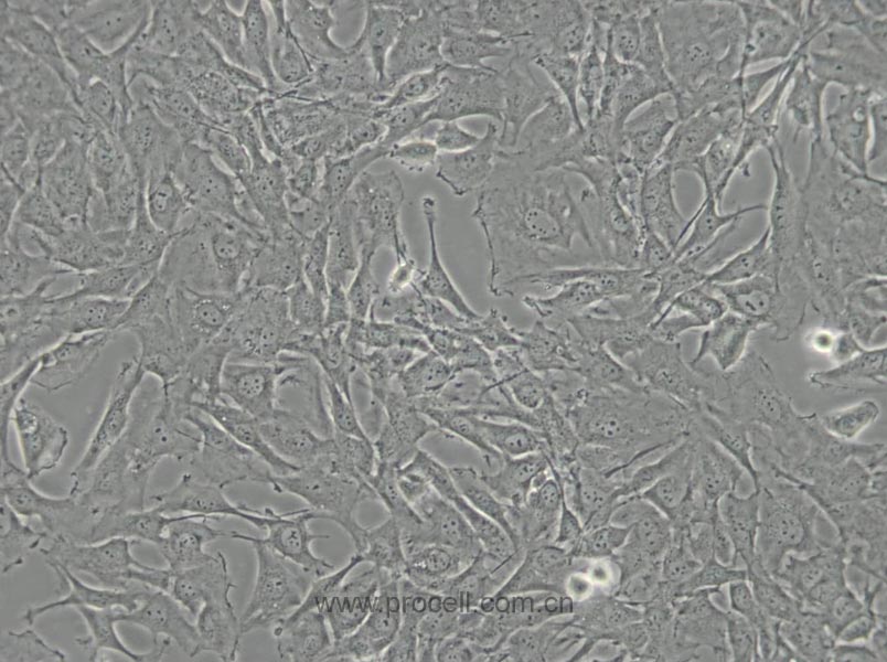 SW579 [SW 579; SW-579] (人甲状腺鳞癌细胞) (STR鉴定正确)