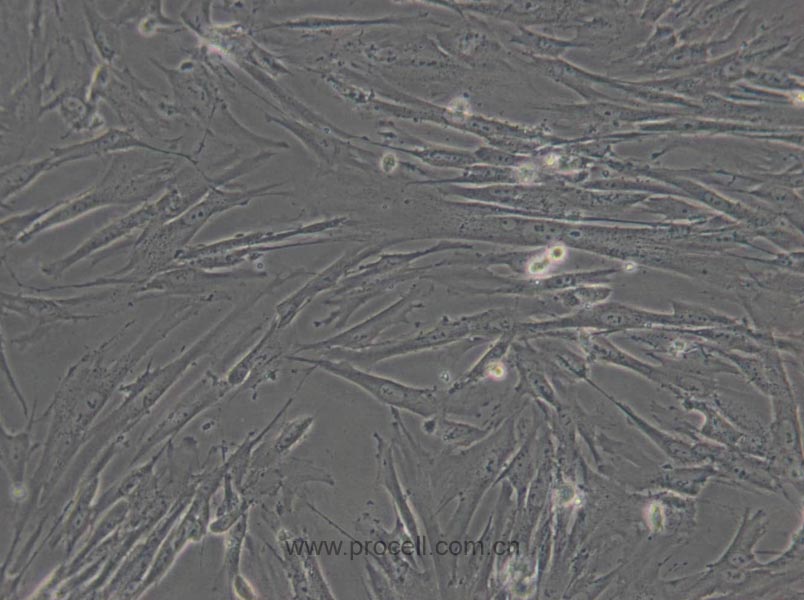 WI-38 (人胚肺细胞) (STR鉴定正确)