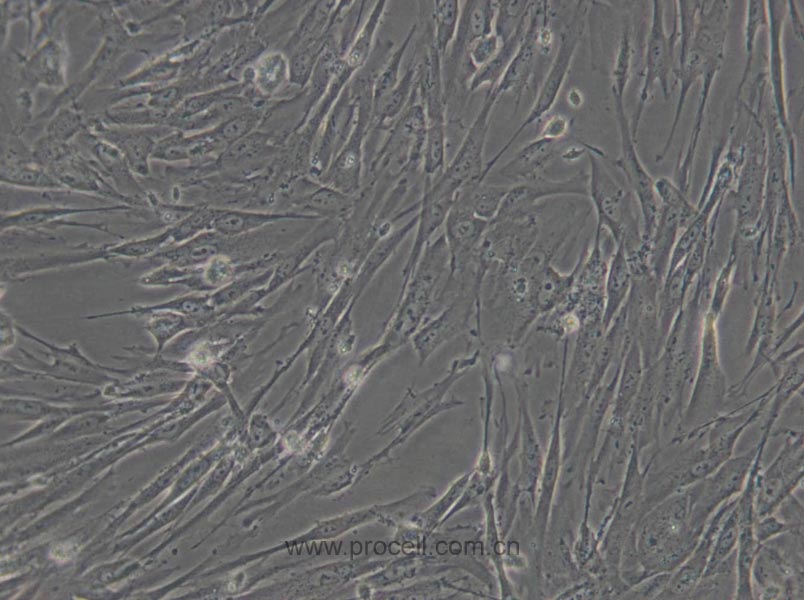WI-38 (人胚肺细胞) (STR鉴定正确)