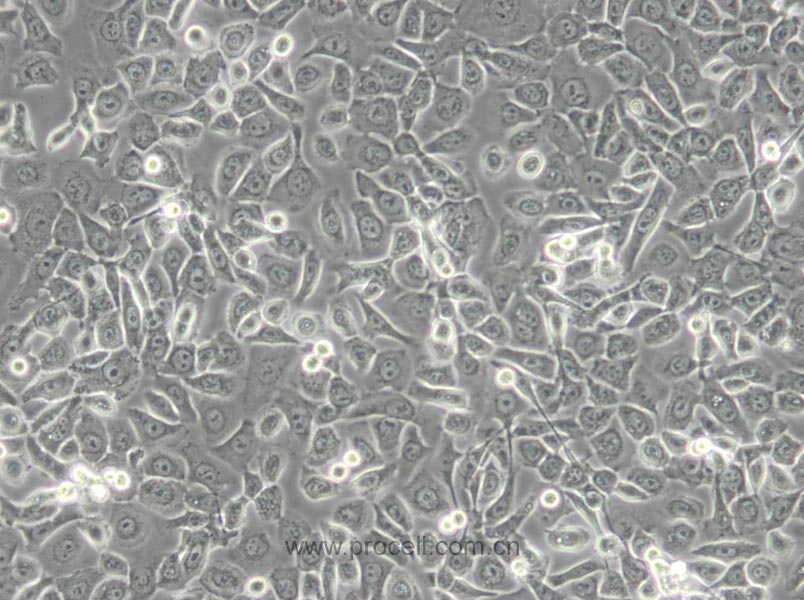 HCC 94 [HCC941122] (人子宫鳞癌细胞(高分化)) (STR鉴定正确)