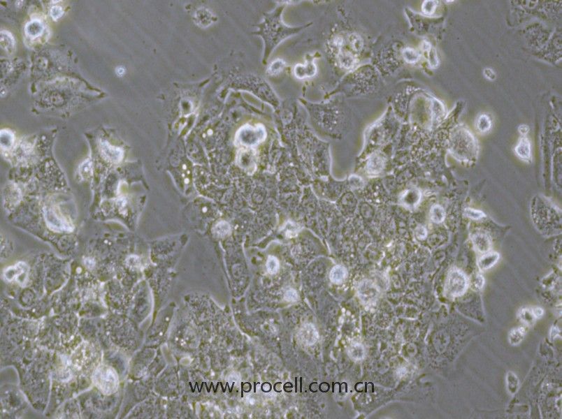 HCCLM3 （人高转移肝癌细胞）（STR鉴定正确）