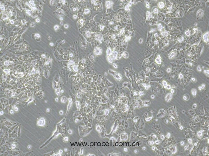 HCCLM3 （人高转移肝癌细胞）（STR鉴定正确）