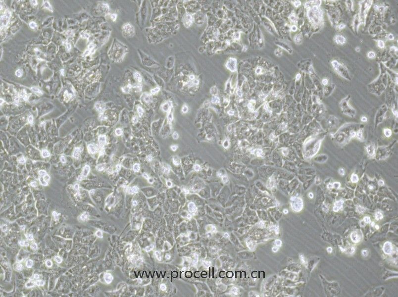 HCCLM3 （人高转移肝癌细胞）（STR鉴定正确）