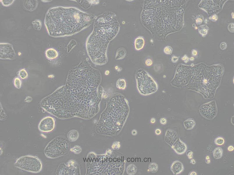 SW1116 (人结肠腺癌细胞) (STR鉴定正确)