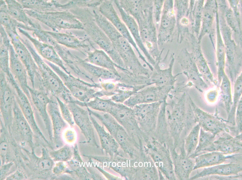 HS 683 (人脑胶质瘤细胞) (STR鉴定正确)