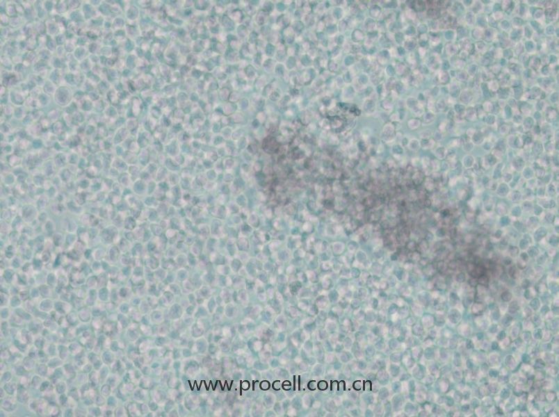 IM-9 (人外周血B淋巴细胞) (STR鉴定正确）