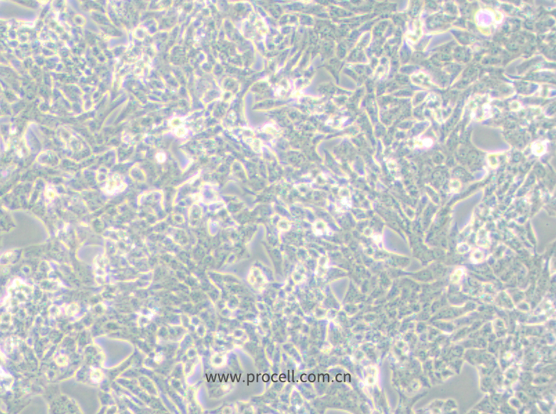 NCI-H295R (人肾上腺皮质腺癌细胞) (STR鉴定正确)