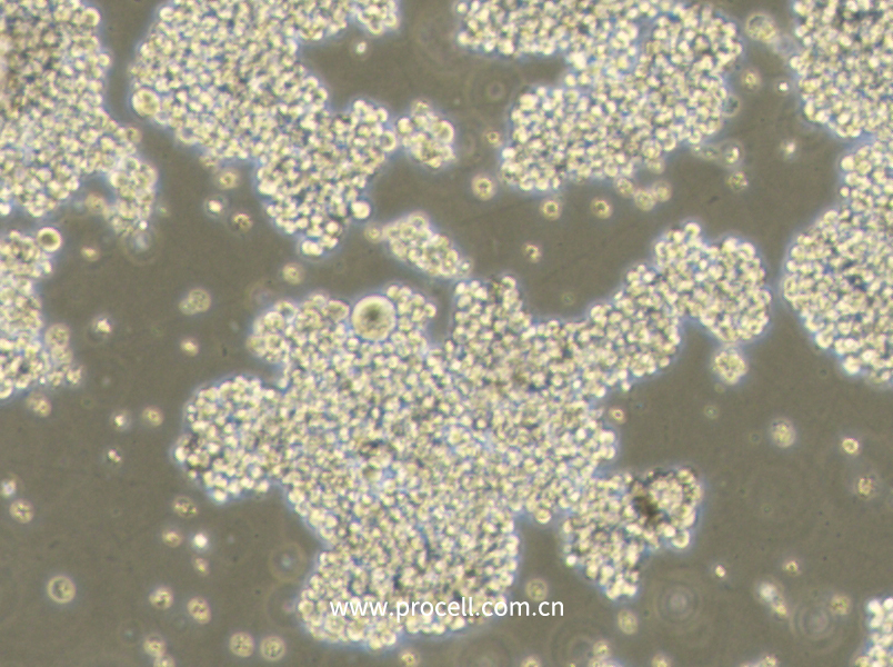 NCI-H716 [H716] (人结直肠腺癌细胞) (STR鉴定正确)