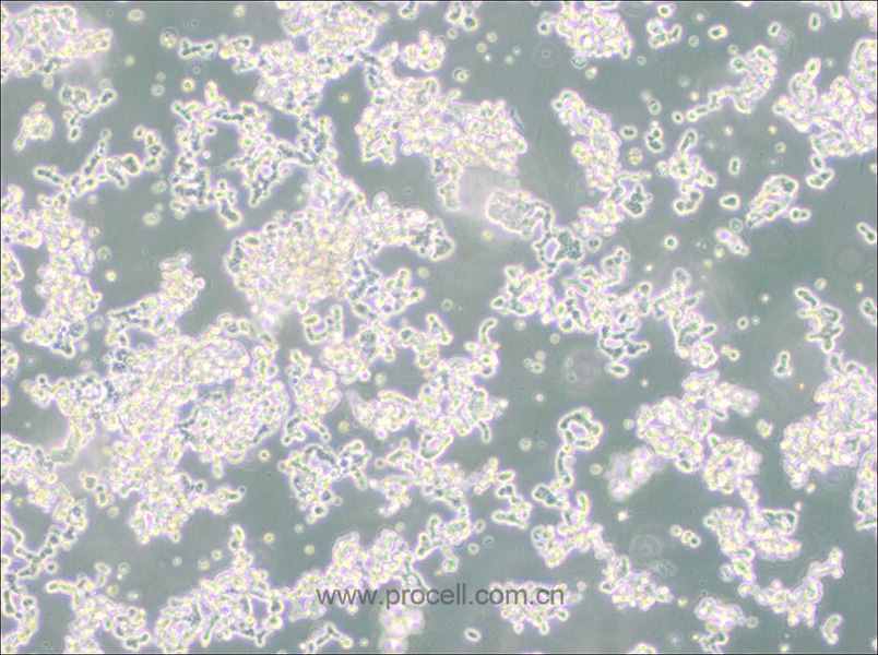 WERI-Rb-1 (人视网膜神经胶质瘤细胞) (STR鉴定正确)