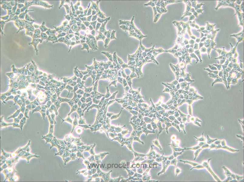 293T/17 (人胚肾细胞) (STR鉴定正确)