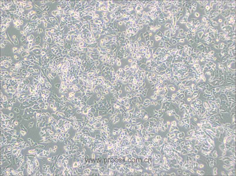 PC-12(Low differentiation) (大鼠肾上腺嗜铬细胞瘤细胞(低分化)) (种属鉴定正确)