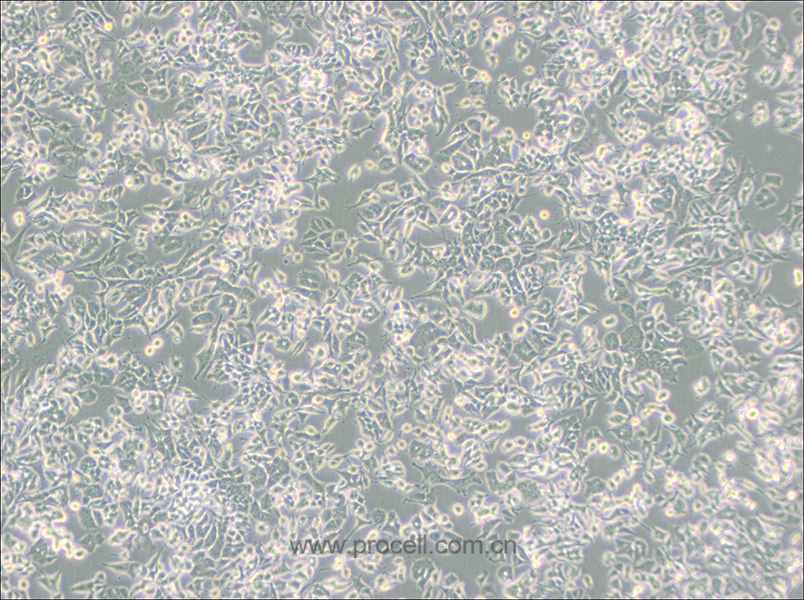 PC-12(Low differentiation) (大鼠肾上腺嗜铬细胞瘤细胞(低分化)) (种属鉴定正确)