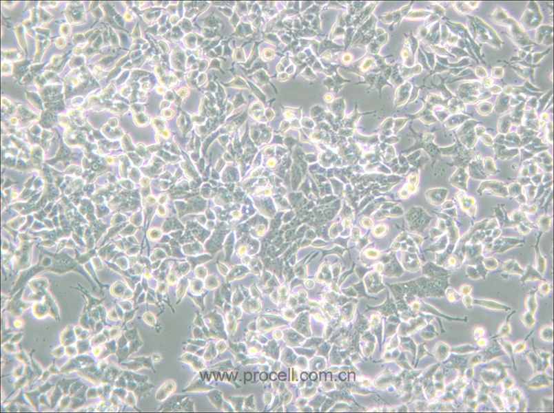 PC-12(Low differentiation) (大鼠肾上腺嗜铬细胞瘤细胞(低分化)) (种属鉴定正确)