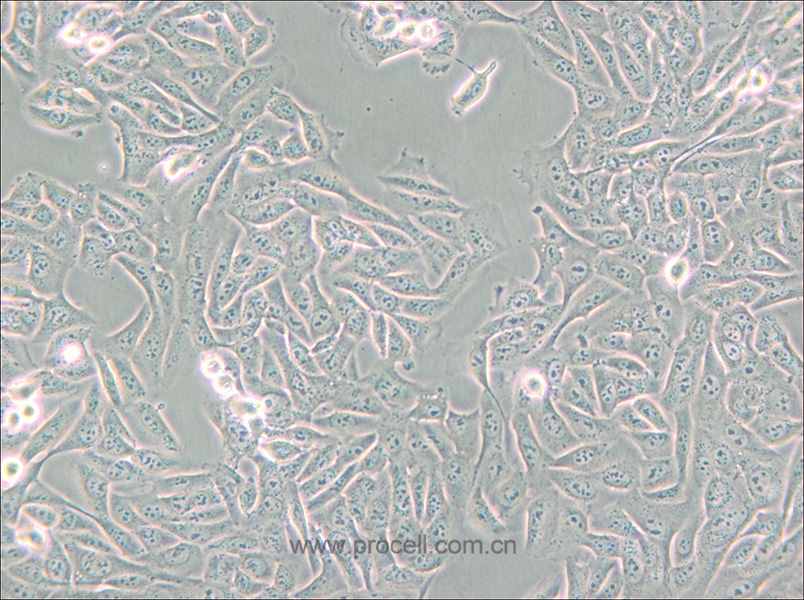 MNNG/HOS Cl #5 [R-1059-D] (人骨肉瘤细胞) (STR鉴定正确)