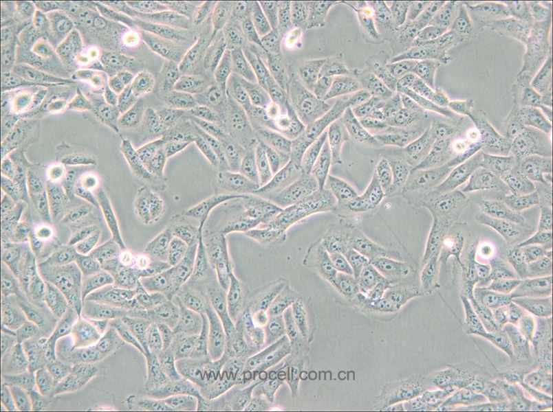 MNNG/HOS Cl #5 [R-1059-D] (人骨肉瘤细胞) (STR鉴定正确)