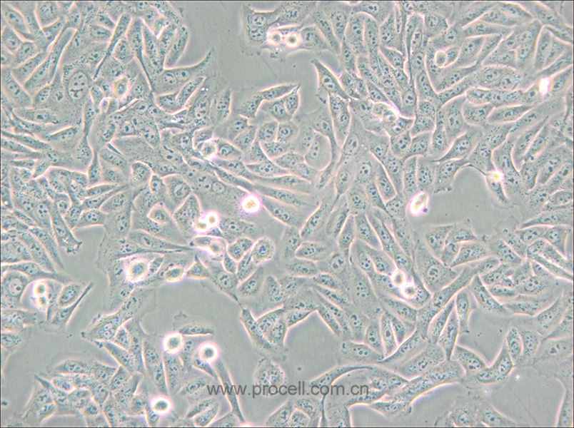 MNNG/HOS Cl #5 [R-1059-D] (人骨肉瘤细胞) (STR鉴定正确)