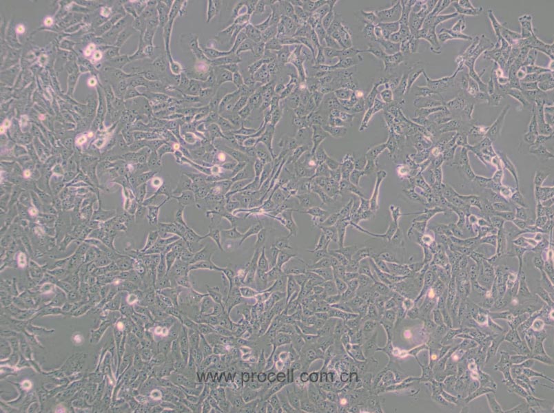 MNNG/HOS Cl #5 [R-1059-D] (人骨肉瘤细胞) (STR鉴定正确)