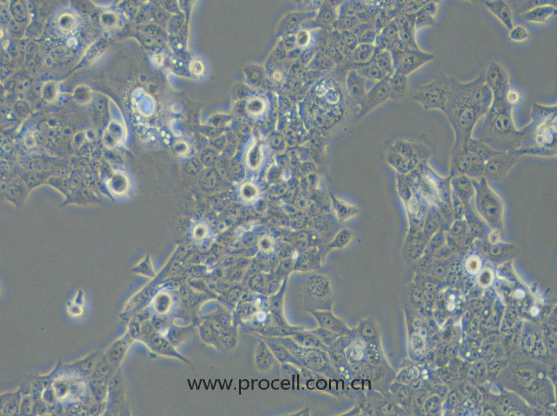 NCI-H441 (人肺腺癌细胞) (STR鉴定正确)