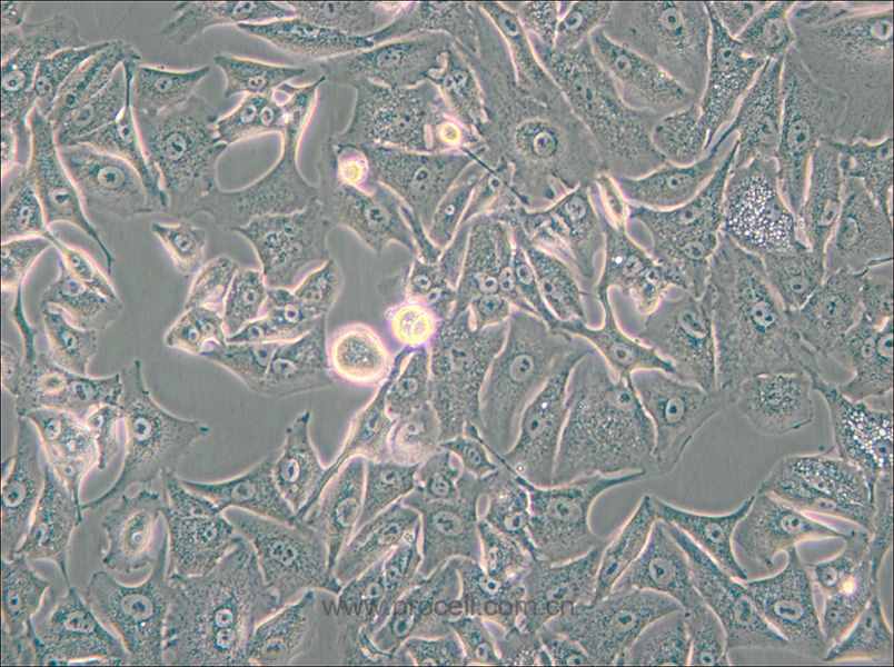 A549-DDP (人肺腺癌耐顺铂株)(STR鉴定正确)