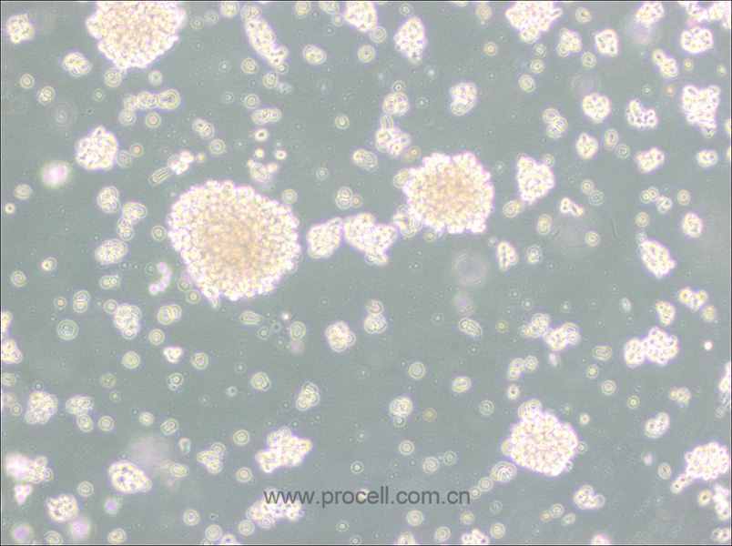 NK-92MI (人恶性非霍奇金淋巴瘤患者的自然杀伤细胞) (STR鉴定正确)