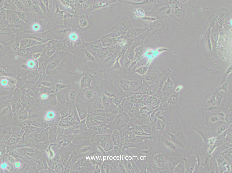 SCC-9 [SCC 9; SCC9] (人舌鳞癌细胞) (STR鉴定正确)