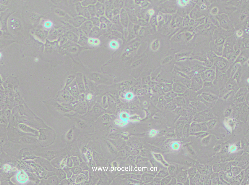 SCC-9 [SCC 9; SCC9] (人舌鳞癌细胞) (STR鉴定正确)