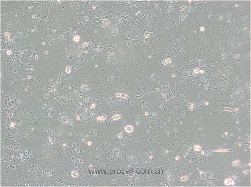 NCI-H2347 (人肺癌细胞) (STR鉴定正确)