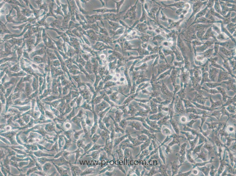 CAL-62 (人甲状腺癌细胞(未分化)) (STR鉴定正确)