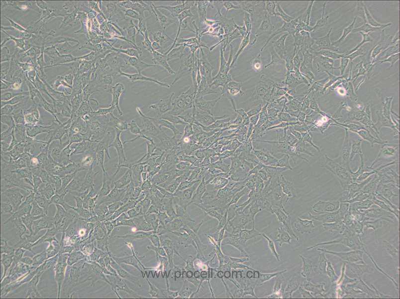 KHM-5M (人甲状腺癌细胞(未分化)) (STR鉴定正确)