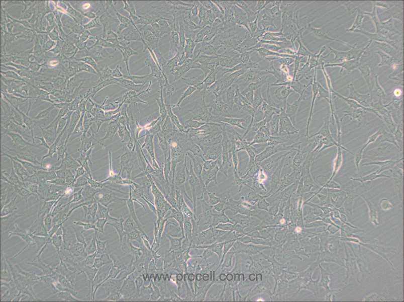 KHM-5M (人甲状腺癌细胞(未分化)) (STR鉴定正确)