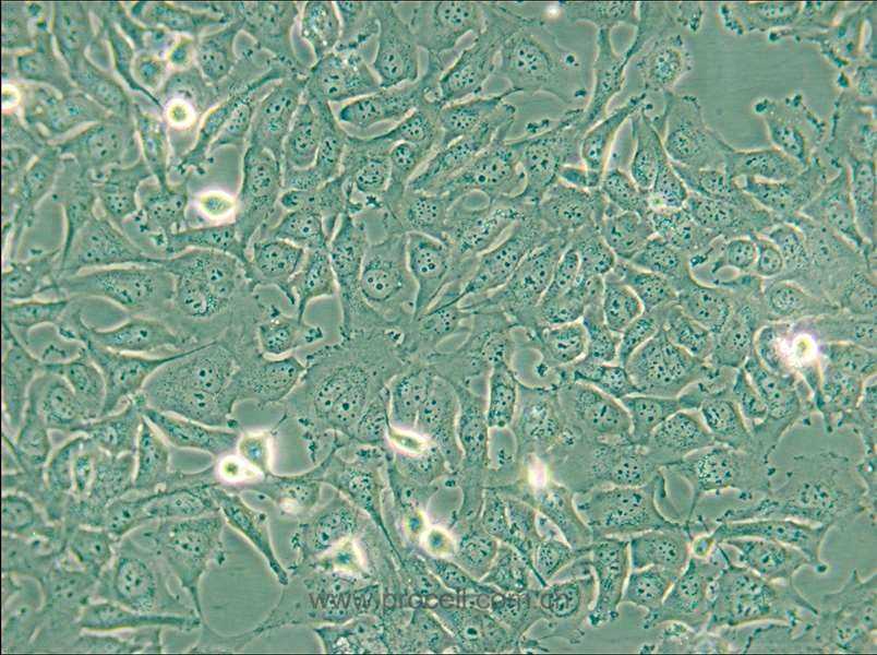 KHM-5M (人甲状腺癌细胞(未分化)) (STR鉴定正确)