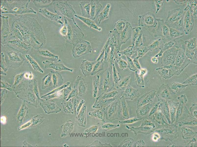 TCCSUP (人膀胱癌细胞) (STR鉴定正确)