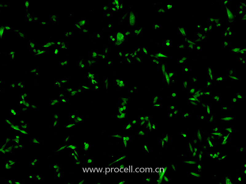 MDA-MB-231-GFP (人乳腺癌细胞(绿色荧光蛋白标记) (STR鉴定正确)